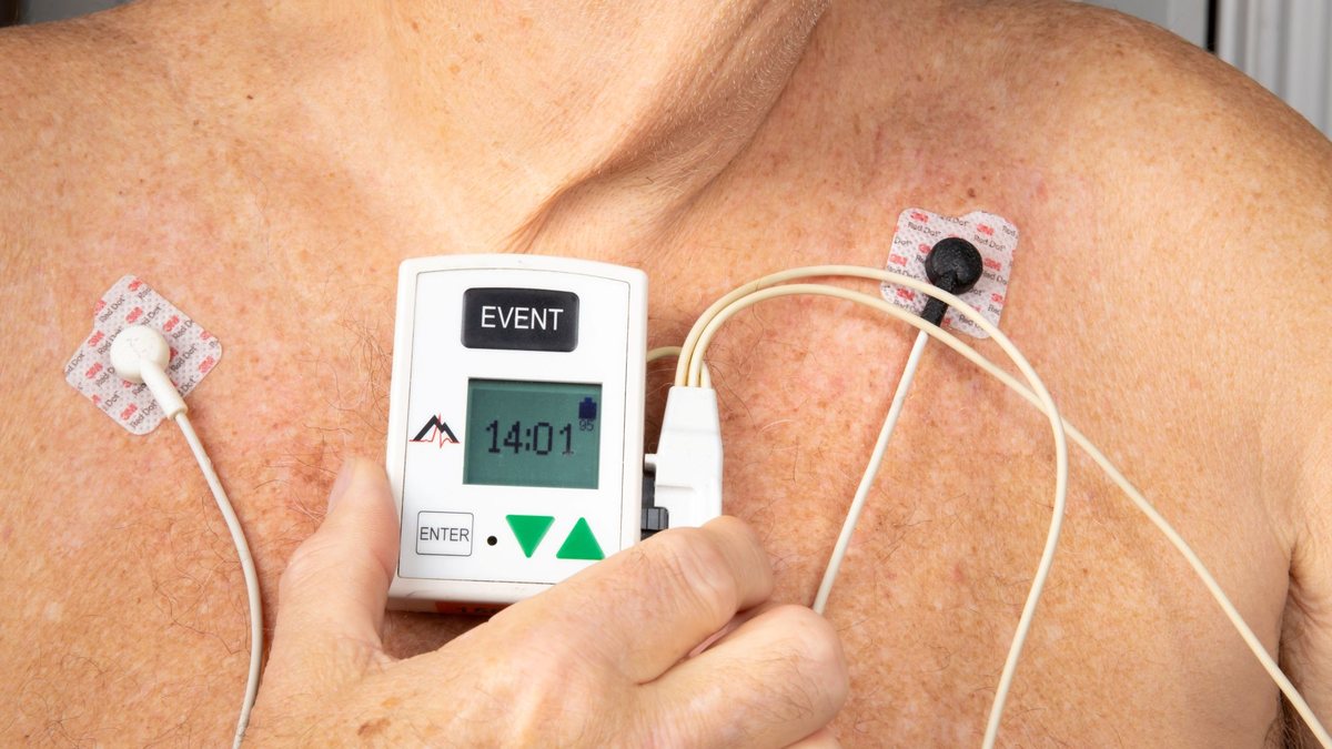 A recomendação é iniciar o acompanhamento cardiológico regular a partir dos 40 anos, mas algumas pessoas precisam iniciar antes; veja quando buscar um médico - AdobeStock
