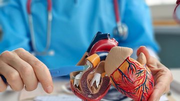 Wainua seria usado no tratamento da cardiomiopatia amiloide por transtirretina - Adobe Stock