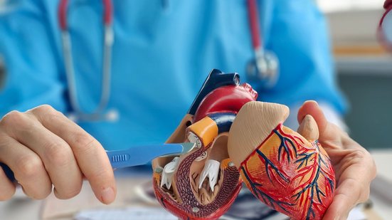 Wainua seria usado no tratamento da cardiomiopatia amiloide por transtirretina - Adobe Stock