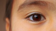 Para identificar estrabismo, é importante observar os olhos e se aproximam os objetos do rosto para enxergar - Pexels