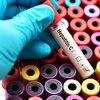 As hepatites são causadas por microorganismos que têm uma predileção específica por infectar as células do fígado - Adobe Stock