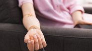 Soroterapia só deve ser adotada no tratamento de casos diagnosticados por profissionais habilitados - Adobe Stock