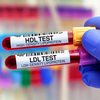O acompanhamento das frações de colesterol no sangue é importante para prevenção de doenças como o infarto e AVC - Adobe Stock