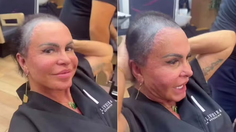 Gretchen raspa a cabeça antes de transplante capilar - Reprodução/Instagram @mariagretchen