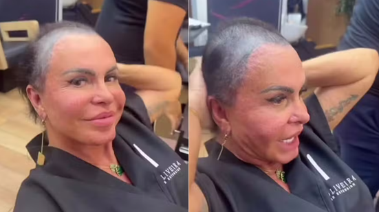 Gretchen raspa a cabeça antes de transplante capilar - Reprodução/Instagram @mariagretchen