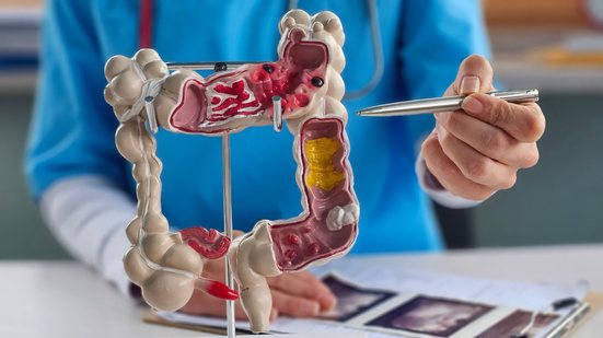 Tratamento pode redefinir o padrão de cuidados após a ressecção do tumor - Adobe Stock