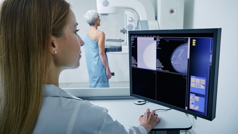 Se a mulher vier a notar alterações na mama é preciso ter um diagnóstico médico de imediato - Adobe Stock