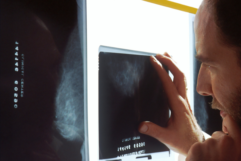 Médico analisando radiografia, olhando atentamente para os detalhes da imagem em um negatoscópio