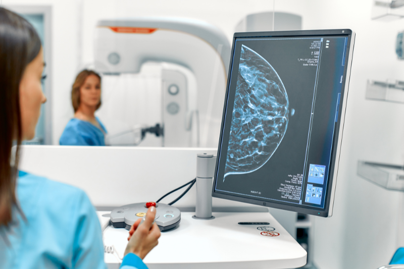 Tela com que mostra exame de mamografia enquanto paciente está em outra sala fazendo o exame