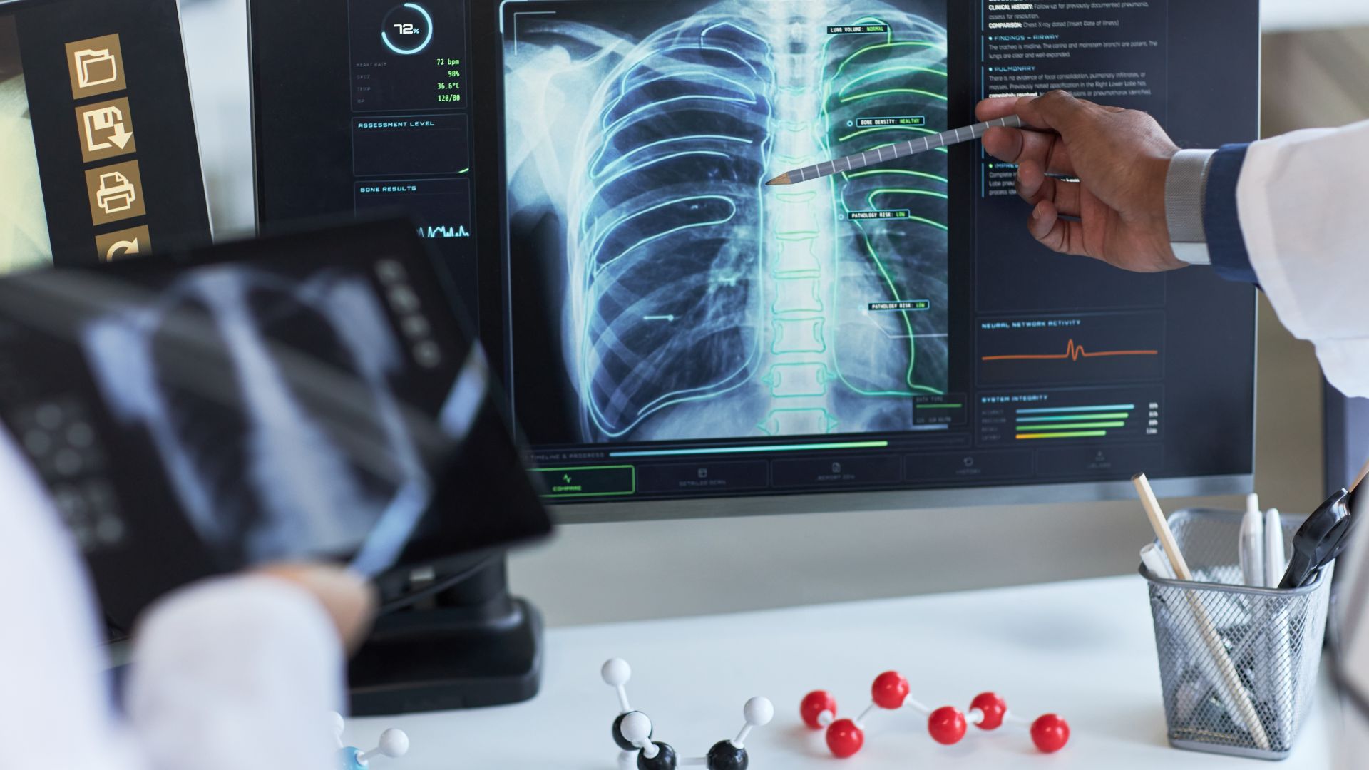 médicos vendo um raio x digital no computador